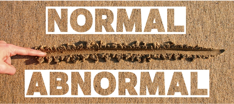 An image illustrating the Window of Tolerance